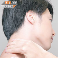 頸背： 經常被太陽灼傷的部位，脫皮時有礙觀瞻。