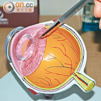 眼球因素是判斷能否做激光矯視手術的其中因素。