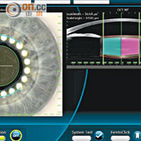 「飛秒激光白內障治療」儀器，以高解像的光學素描（OCT）可快速鎖定及分析晶體位置。