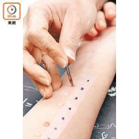 接受「皮膚針刺測試」，就可以試驗到患者對哪種致敏原有過敏反應。