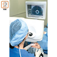 傳統的Lasik矯視手術需要以打開角膜瓣的方式進行，但在恢復近視、遠視、散光的度數上限會較高。