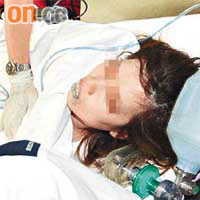 狂飲伏特加烈酒疑引致酒精中毒的女子送院急救。	（呂浩鋒攝）