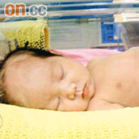 女嬰甫出生即患上壞死性腸炎，疑未獲適切治療而死。