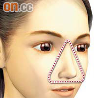 嘴角兩端至雙眼中間點呈現的三角位置被稱為臉部危險三角區，施手術時要特別謹慎。