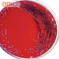 克雷伯士氏桿菌是常見於空氣中的細菌。