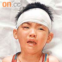 誤墮沙井受傷的男童頭破血流。	（資料圖片）