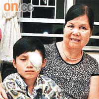陳童左眼受傷在家休息，由祖母照顧。