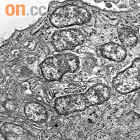 引致恙蟲病的立克次體在顯微鏡下的模樣。