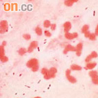 肺炎鏈球菌