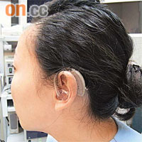 改善耳鳴可用「以毒攻毒」方法，如佩戴耳鳴掩閉器。