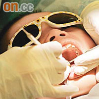 長期病患者或一般市民都應定期進行牙齒檢查。