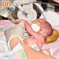 早產超輕嬰兒需要較多的護理。	（資料圖片）