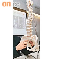 人體腰脊有多節椎骨，做錯手術的影響可大可小。
