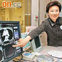 羅吳美英表示，炫速雙源電腦掃描系統是全球首部可檢測器官功能的掃描儀器。