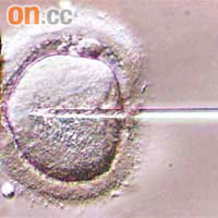 卵胞漿內單精子注射治療，是將單一精子直接注射進卵子內。