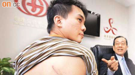陳先生（左）今年二月胸腔積膿，接受開刀手術放膿後，背部留下十多厘米的疤痕。	（高嘉業攝）