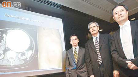 鄭永強（右）及謝卓華（左）均指本港病人對主動脈瘤較陌生，六成個案在主動脈瘤爆破後才緊急送院。William Stone（中）指一旦主動脈瘤爆破，死亡率可達八成。	（霍振鋒攝）