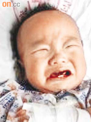 國家衞生部指全國約有廿九萬嬰兒因飲用毒奶粉而患腎結石。