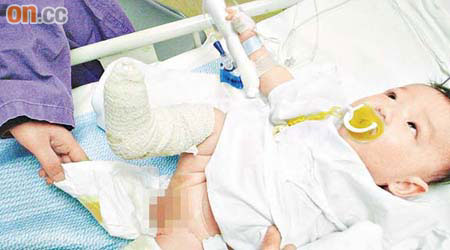 瑪嘉烈醫院早前發生「滾水淥B」事件，一名男嬰下體、臀部及雙腳等皮膚被二級燒傷，更要插尿喉輔助排尿。	（資料圖片）
