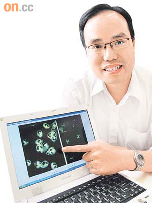 梁滿濠醫生指，中性粒細胞胞漿抗體在顯微鏡下會亮綠燈。