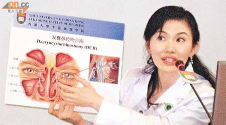 余珊醫生上月曾介紹以微創手術治療淚管阻塞。
