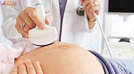 孕婦產前超聲波檢查。