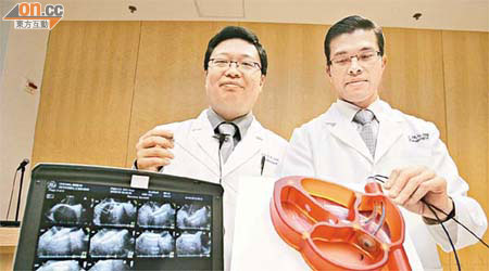 余卓文（右）及林逸賢（左）指最新的心臟內超聲波儀器，可清楚監察堵塞器於心房間隔缺口打開情況。（梁耀榮攝）