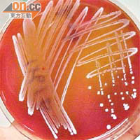 腸道鏈球菌可致尿道炎，一旦入血可以致命。