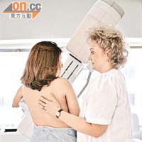 女性定期接受乳房造影檢查，有助及早診斷乳癌。	（資料圖片）