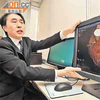 麥耀光稱新一代掃描影像清晰，心臟病隱性患者預測值達到百分百。