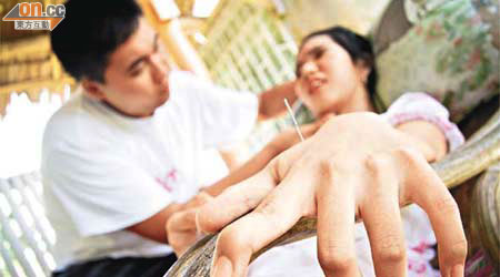 港中醫義工在菲國為病人針灸治療。	（港台圖片）