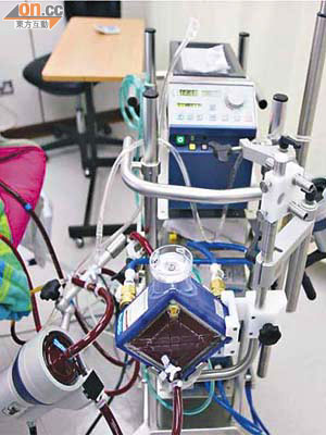 人工肺的儀器，可將病人血液於體外加氧再送回體內，暫代心肺功能。	（資料圖片）