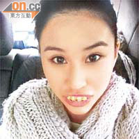 何超蓮在微博上載一張她戴了假牙糖的照片，樣子趣怪。