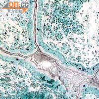 在顯微鏡下，沙士病毒感染細胞（藍紫色細胞）沿唾液管（綠色部分）分布。