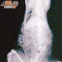 Ｘ光照片可見貓女的脊椎被打至折斷。	（香港非牟利獸醫診所提供）