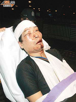 遭夜青毒打的男子面部紅腫，由救護員送院治理。	（周宏杰攝）