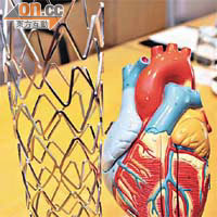 醫學界近年多用滲藥性支架（左為放大模型）進行心臟通波仔手術。