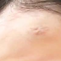 童童額頭有曾經受傷的疤痕。	（互聯網）