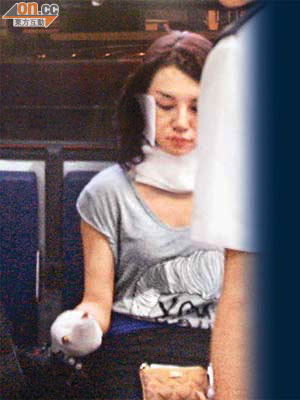 美女煙民右臉、右手受傷，在救護車上接受治理。（馬竟峯攝）