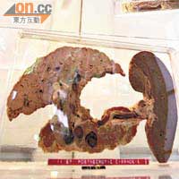 展覽場內展出感染結核的器官標本，顯示結核桿菌對人體的傷害。