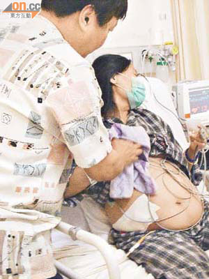 蔡女士於手術後肺腹積水情況嚴重，與懷有七、八個月身孕無異。