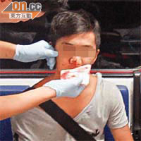 一名男子被打至流鼻血，救護員替他包紮。