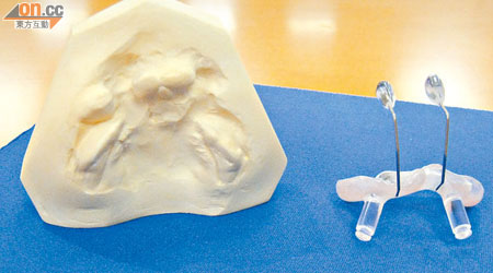 患者可於出生一周後佩戴「鼻及牙槽塑形器」收窄唇顎的裂縫。