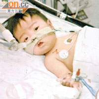 嬰兒時的藍健朗曾進行肝臟移植。