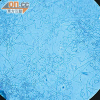 髮癬菌的繁殖速度慢，約三至四周才會成功種菌，菌的形狀像一條小彈弓。