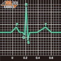 電流每次通過心臟均會形成「QT波」，若每次間隔過長，有機會令心跳紊亂猝死。