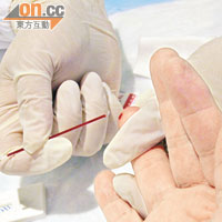 市民可透過快速抽血測試，了解有否感染乙肝。