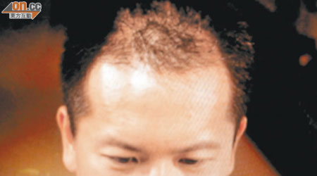 台灣史雲遜護髮的廣告被指「前後對照」照片造假。（資料圖片）