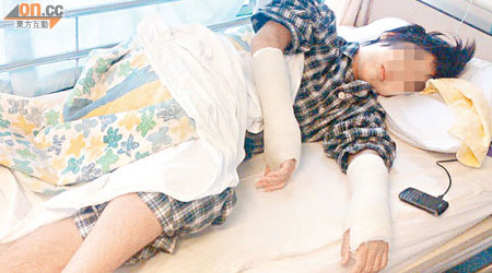 少年跳橋後雙手骨折腳部受傷，曾留醫三星期。（讀者提供圖片）