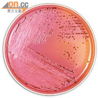沙門氏菌平常只會令人感冒，但因干擾素受阻致免疫系統缺失的患者有機會細菌入血。